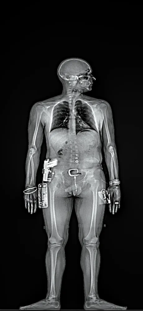 Before Juka™ scan showing limited detection with traditional X-ray technology