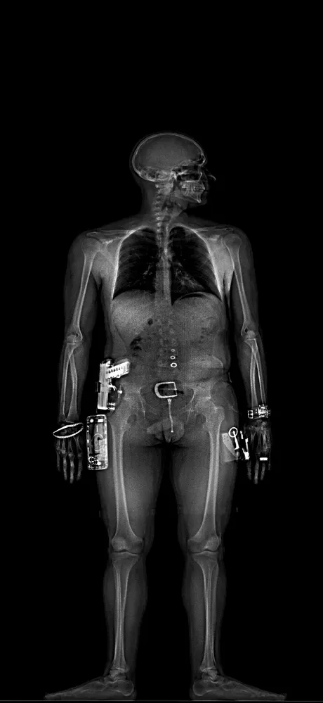 After Juka™ scan displaying enhanced detection with advanced imaging clarity